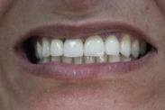 cosmetic-dentistry